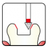 Osung Etcetera Finishing Bur FG Shank 159-10EF1 (161AFN-010EF) Extra Fine (Super Fine) Grit Diamond Bur 5/PK